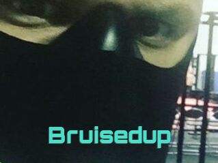 Bruisedup