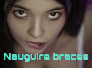 Nauguire_braces